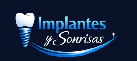 Implantes dentales en Cali | Diseño de sonrisa en Cali 